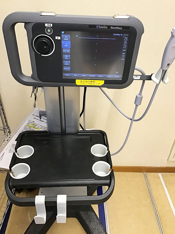 超音波画像診断装置 ポータブルエコー sonosite nanomaxx - 福岡県の家具